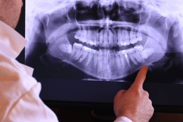 Best Broken or Cracked Tooth Emergency Dentist in Mcgovern, PA